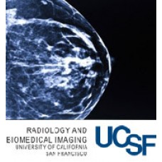 UCSF Breast Imaging and Digital Mammography
